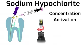 #Sodium Hypochlorite Irrigation in Endodontics Part 1- Advantage/ Disadv, Concentration & Activation