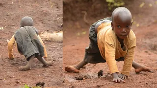 The Incredible Little Boy With Legs Like Scissors | BORN DIFFERENT