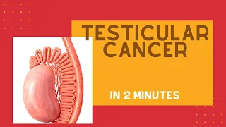 Testicular cancer in under 2 mins!