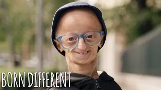 I'm 21 - But I Age Seven Times Faster | BORN DIFFERENT