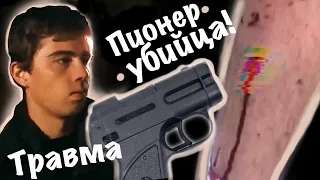 Пистолет ПИОНЕР! Применение на ЧЕЛОВЕКЕ! СИГНАЛ ОХОТНИКА В НОГУ!