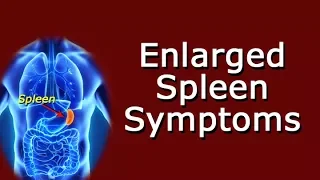 Enlarged Spleen Symptoms