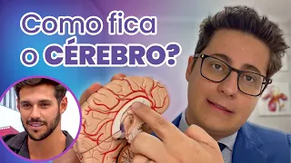 O que é TRAUMATISMO craniano? Entenda o que acontece após um acidente!