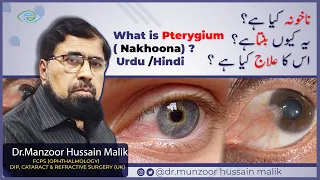What is Pterygium( Nakhoona) ? Eye Tips and treat Urdu /Hindi