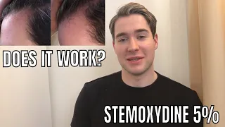 STEMOXYDINE 5% REVIEW - Kerastase Densifique Homme