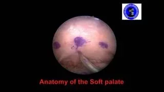 Anatomy of the Soft Palate