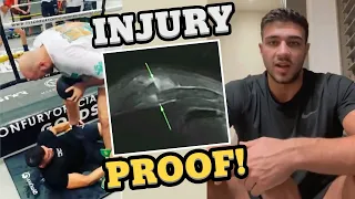 PROOF of Tommy Fury INJURY Forcing Withdrawal from Jake Paul Fight - Doctor Explains