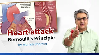 Heart attack- Bernoulli’s Principle |MUNISH Sir