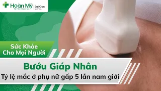 Bướu giáp nhân | Nguyên nhân, Dấu hiệu, Điều trị và Phòng bệnh