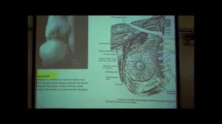 ANATOMY; LYMPHATIC SYSTEM by Professor Fink