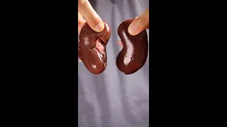 How To Make Kidneys