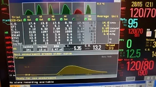 Cardiac output (the longer version)