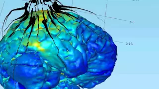 Computer stimulation of tDCS current flow through head and brain