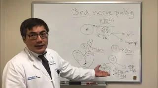 Cranial Nerve 3 (CN III) Palsy