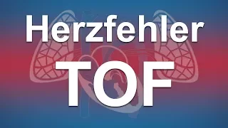 Herzfehler einfach erklärt: Fallot'sche Tetralogie (TOF)