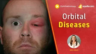 Orbital Diseases | Medical School | Ophthalmology Education Videos Lecture | V-Learning