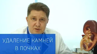 Эндоскопическая хирургия: удаление камней в почках без разрезов