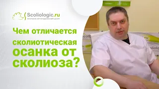 Чем отличается неправильная осанка от сколиоза?