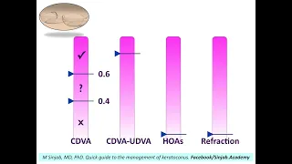 Quick Guide to the Management of Keratoconus: Part 6