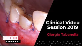 Giorgio Tabanella / Clinical Video Session 2019