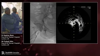 Stenting unilateral chronic disease on right hand side - Chapter 6