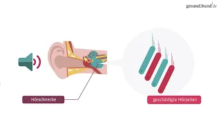 Was ist ein Tinnitus?