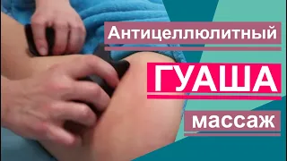 Антицеллюлитный массаж гуаша . Уникальная техника. Anti-cellulite massage gouache.