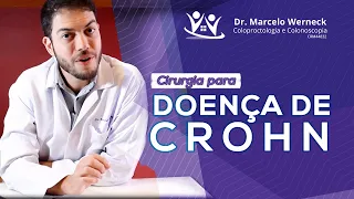 Cirurgia para doença de Crohn | Dr. Marcelo Werneck