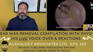 EAR WAX REMOVAL COMPILATION WITH RHYS VOICEOVER & REACTION - EP 323