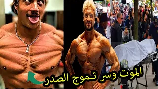 فاجعة موت جو ليندر وسر تموج عضلات صدره ( مرض نادر سيصدمك!! )