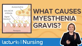 What Causes MYASTHENIA GRAVIS? // Autoimmune Pathophysiology – Med-Surg Nursing | Lecturio