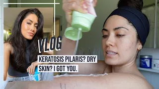 This is how I manage my Keratosis Pilaris [KP] and dry skin on my body | Melissa Alatorre