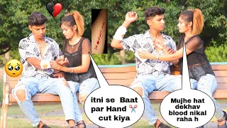 Hand cut prank On Girlfriend || Gone Extremely Wrong 😱 || It's Abshu