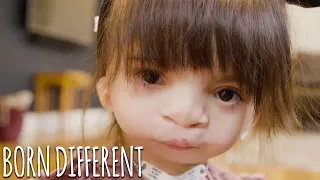 Doctors Can't Explain Our Rare Conditions | BORN DIFFERENT