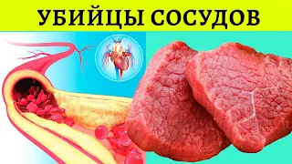 Продукты Засоряющие Сосуды, они могут довести до ИНСУЛЬТА и ИНФАРКТА!