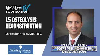L5 Osteolysis Reconstruction - Christopher Holland, MD, PhD