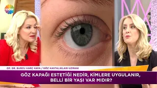 Göz kapağı estetiği nedir?