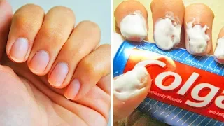 20 einfache Tricks für perfekte Fingernägel