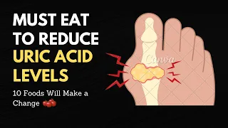 10 FOODS TO RAPIDLY LOWER YOUR URIC ACID LEVELS