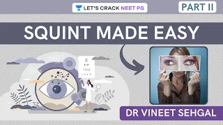 Squint Made Easy - Part II | Ophthalmology | NEET-PG 2021 | Vineet Sehgal