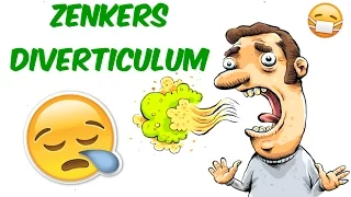 Zenkers Diverticulum- SMELLY BREATH RUINING YOUR DAY!?