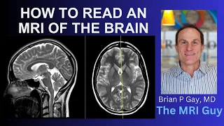 How to read an MRI of the brain | First Look MRI