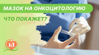 👁️ Мазок на онкоцитологию - что покажет? Онкоцитология шейки матки