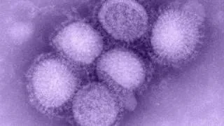 H1N1 Influenza (Gripe porcina) (Swine Flu)