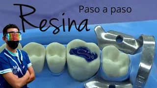 Como hacer una resina dental paso a paso