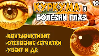 КУРКУМА (видео 10): болезни глаз. Воспаление. Сухость. Увеит. Отслойка сетчатки.