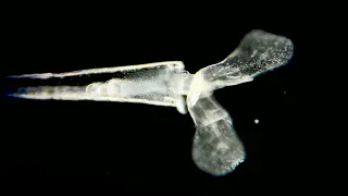 Caribbean plankton under microscope: wonderful and diverse. The music was written by Alek Erickson