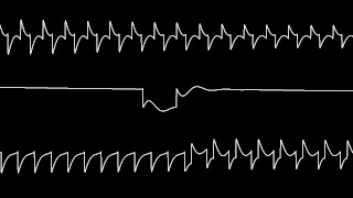 C64 Jeroen Tel's "RoboCop 3" oscilloscope view