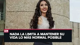 Ana Gabriela, la mujer sin brazos que sueña ser Miss Veracruz