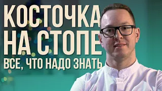 Вся ПРАВДА о ШИШКЕ на стопе | Hallux Valgus